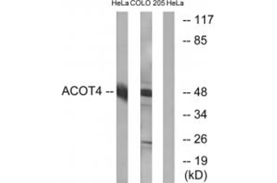 Western blot - ACOT4 Antibody from Signalway Antibody (34382) - Antibodies.com
