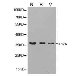 Western blot - IL17A antibody from Signalway Antibody (38147) - Antibodies.com