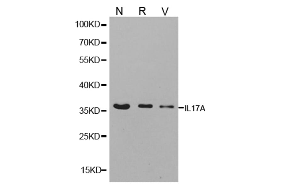 Western blot - IL17A antibody from Signalway Antibody (38147) - Antibodies.com