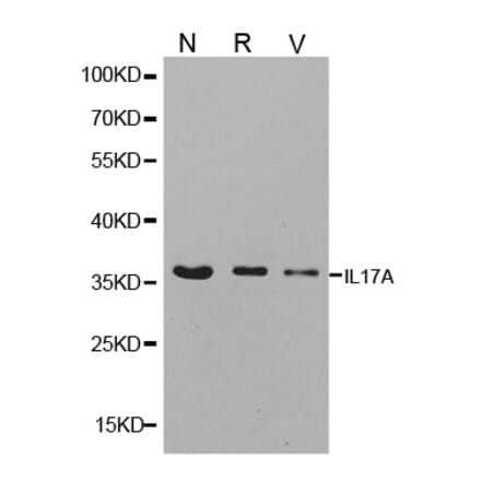Western blot - IL17A antibody from Signalway Antibody (38147) - Antibodies.com