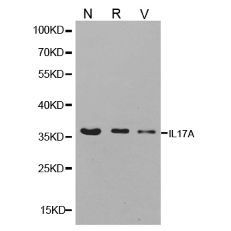 Western blot - IL17A antibody from Signalway Antibody (38147) - Antibodies.com