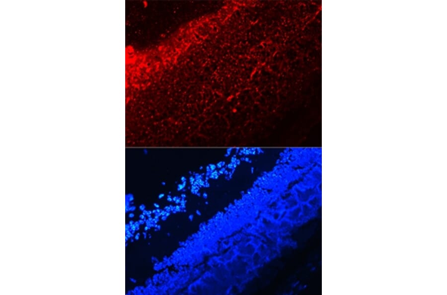 Immunofluorescence - IL17A antibody from Signalway Antibody (38147) - Antibodies.com