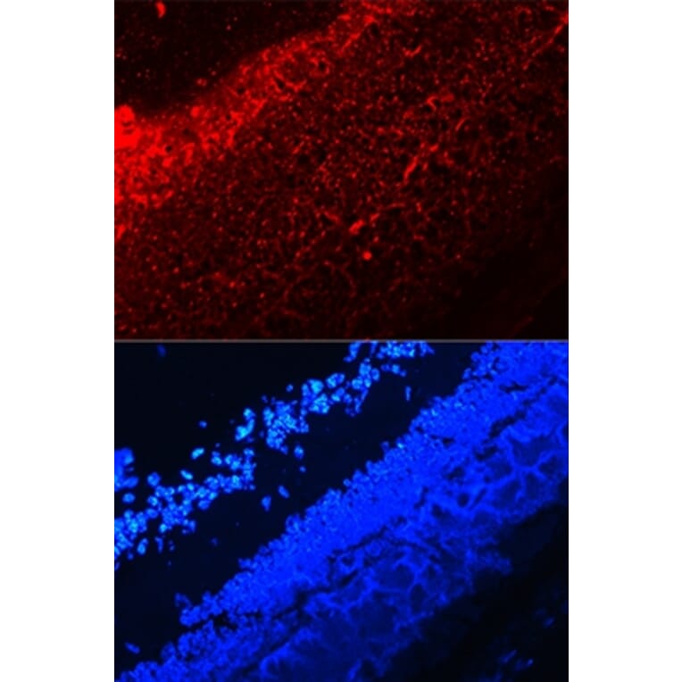 Immunofluorescence - IL17A antibody from Signalway Antibody (38147) - Antibodies.com