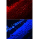 Immunofluorescence - IL17A antibody from Signalway Antibody (38147) - Antibodies.com