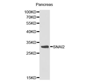 Western blot - SNAI2 antibody from Signalway Antibody (38171) - Antibodies.com