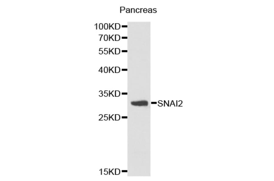 Western blot - SNAI2 antibody from Signalway Antibody (38171) - Antibodies.com