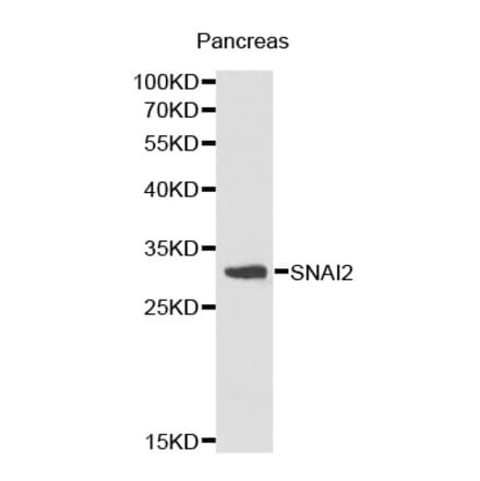 Western blot - SNAI2 antibody from Signalway Antibody (38171) - Antibodies.com