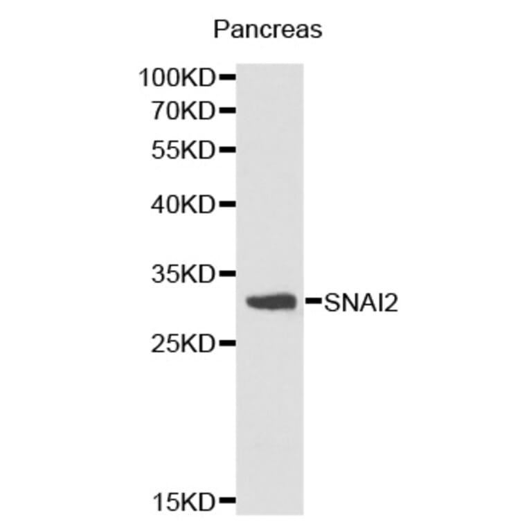 Western blot - SNAI2 antibody from Signalway Antibody (38171) - Antibodies.com