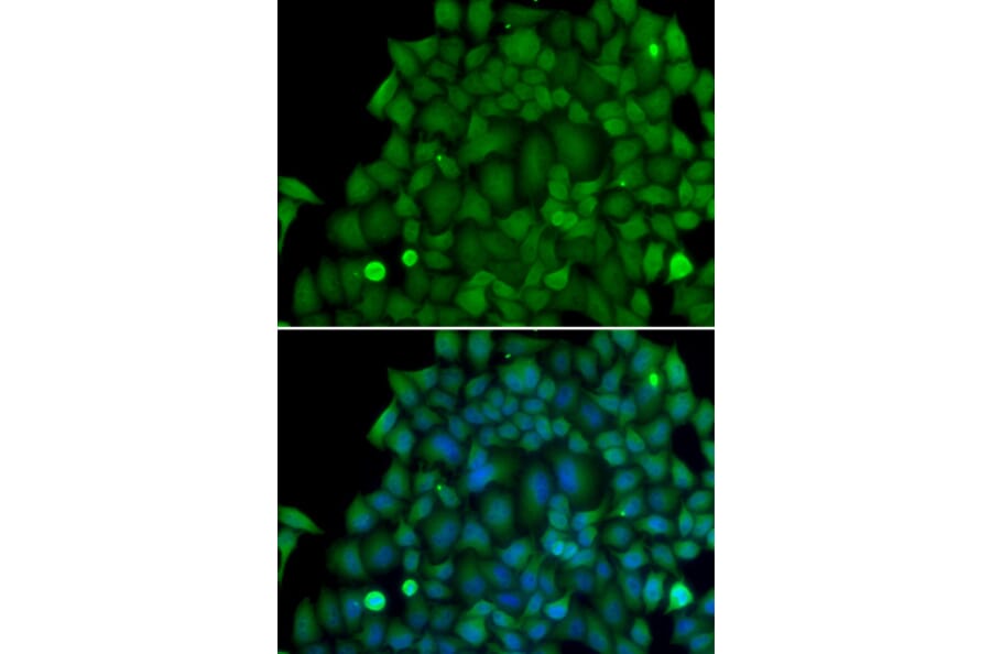 Immunofluorescence - SNAI2 antibody from Signalway Antibody (38171) - Antibodies.com