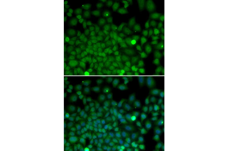 Immunofluorescence - SNAI2 antibody from Signalway Antibody (38171) - Antibodies.com