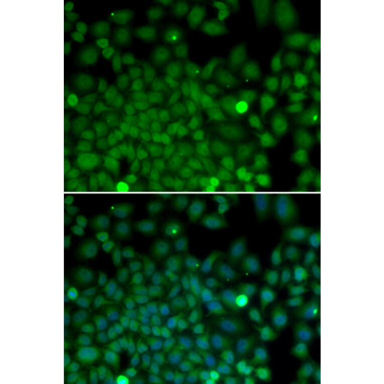 Immunofluorescence - SNAI2 antibody from Signalway Antibody (38171) - Antibodies.com