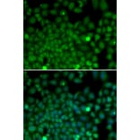 Immunofluorescence - SNAI2 antibody from Signalway Antibody (38171) - Antibodies.com