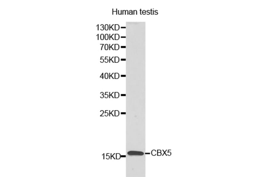 Western blot - LYZL6 antibody from Signalway Antibody (38174) - Antibodies.com