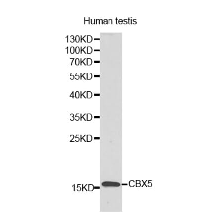 Western blot - LYZL6 antibody from Signalway Antibody (38174) - Antibodies.com