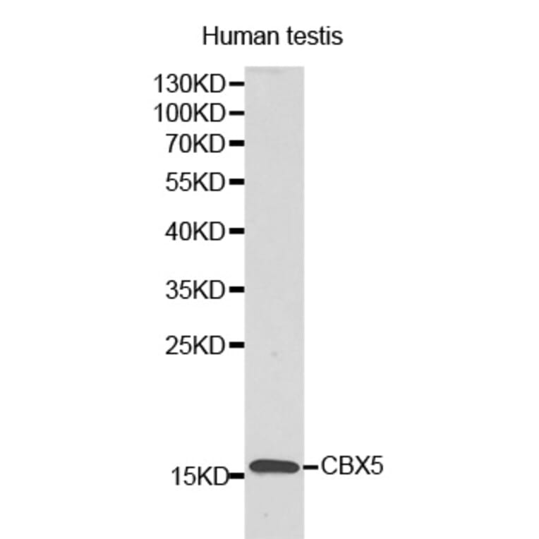 Western blot - LYZL6 antibody from Signalway Antibody (38174) - Antibodies.com