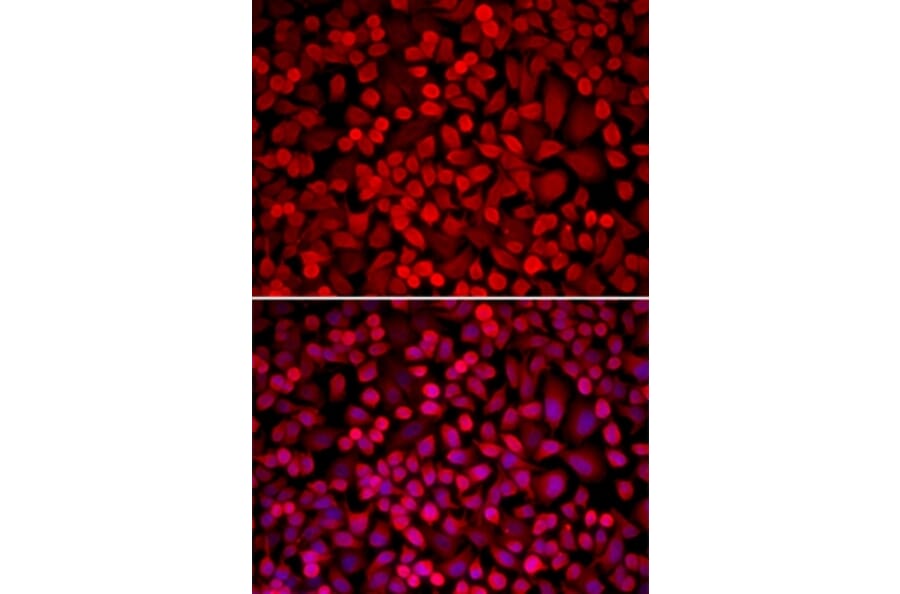 Immunofluorescence - NCOA1 antibody from Signalway Antibody (38196) - Antibodies.com