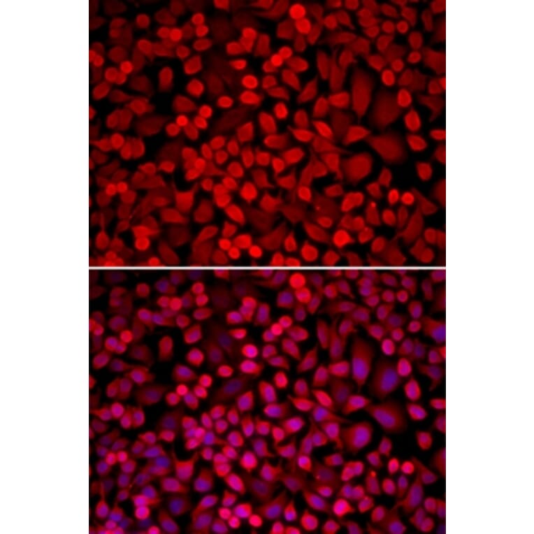 Immunofluorescence - NCOA1 antibody from Signalway Antibody (38196) - Antibodies.com