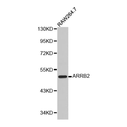 Western blot - ARRB2 antibody from Signalway Antibody (38209) - Antibodies.com