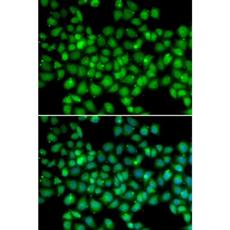 Immunofluorescence - ARRB2 antibody from Signalway Antibody (38209) - Antibodies.com