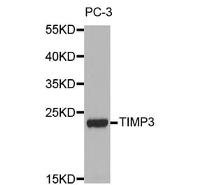 Western blot - TIMP3 antibody from Signalway Antibody (38247) - Antibodies.com