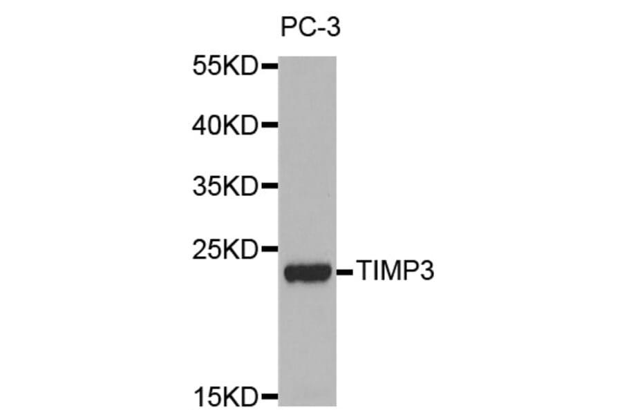 Western blot - TIMP3 antibody from Signalway Antibody (38247) - Antibodies.com