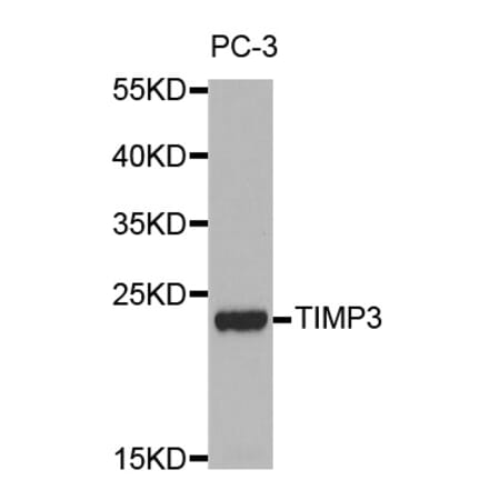 Western blot - TIMP3 antibody from Signalway Antibody (38247) - Antibodies.com