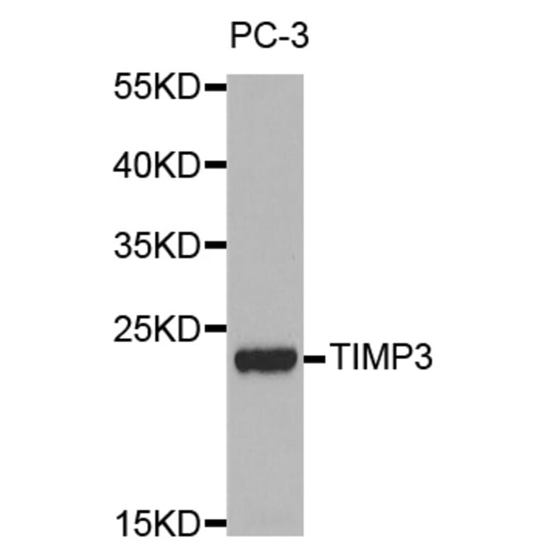 Western blot - TIMP3 antibody from Signalway Antibody (38247) - Antibodies.com