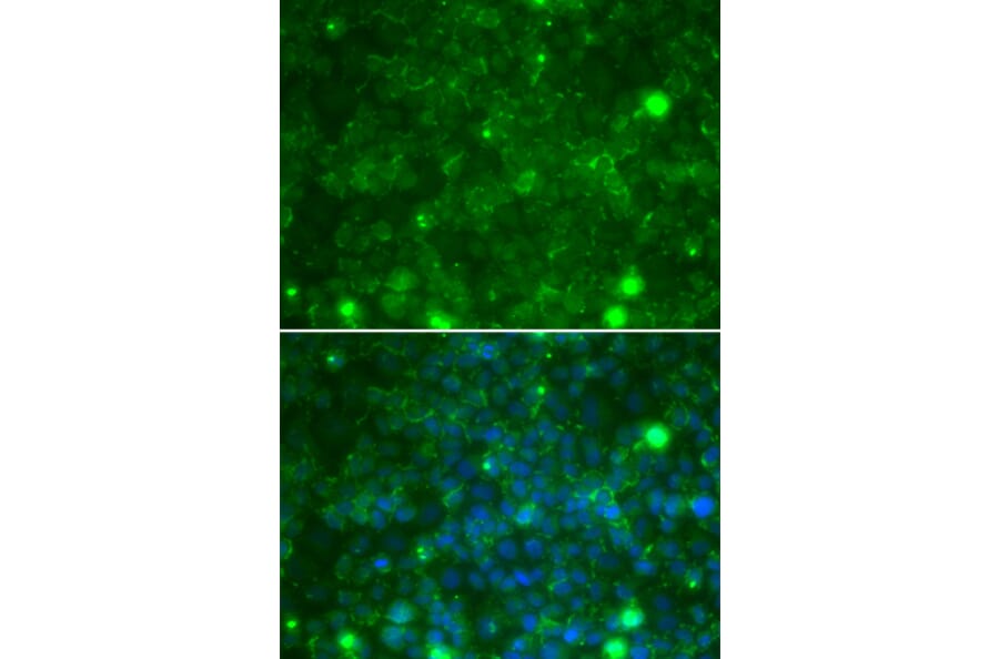Immunofluorescence - TIMP3 antibody from Signalway Antibody (38247) - Antibodies.com