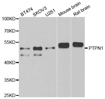 Western blot analysis of extracts of various cell lines, using PTPN1 antibody.