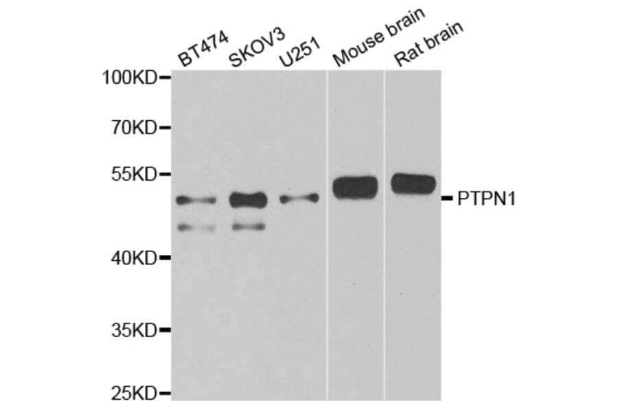 Western blot - PTPN1 antibody from Signalway Antibody (38262) - Antibodies.com