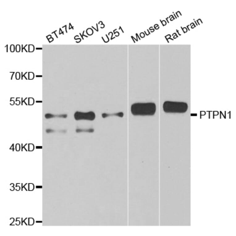 Western blot - PTPN1 antibody from Signalway Antibody (38262) - Antibodies.com