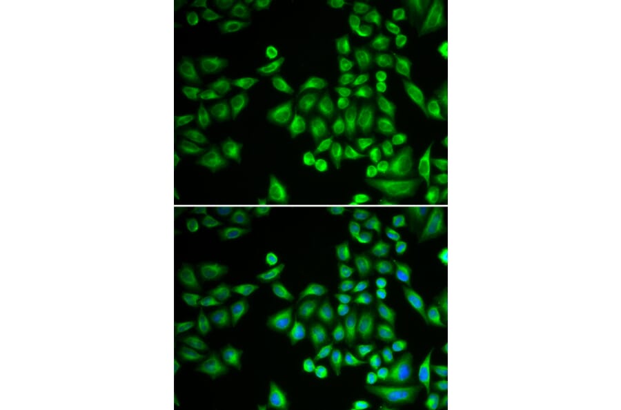 Immunofluorescence - PTPN1 antibody from Signalway Antibody (38262) - Antibodies.com