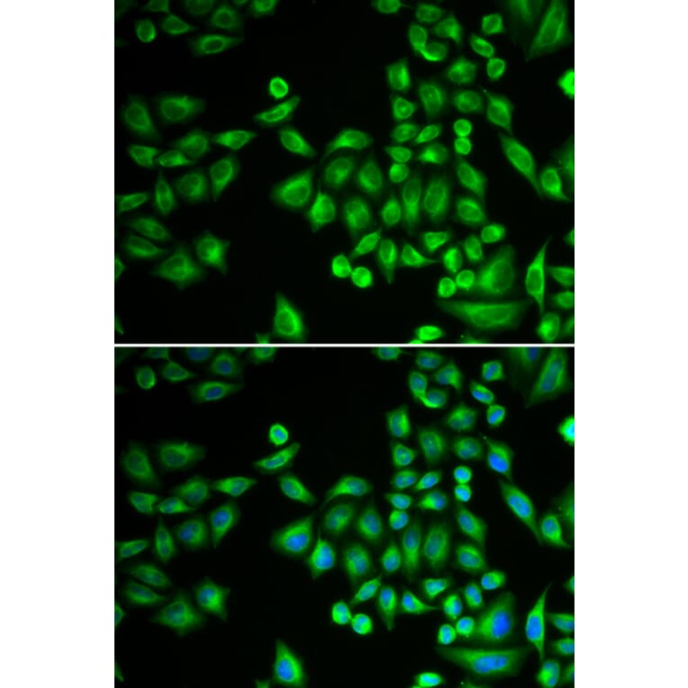 Immunofluorescence - PTPN1 antibody from Signalway Antibody (38262) - Antibodies.com