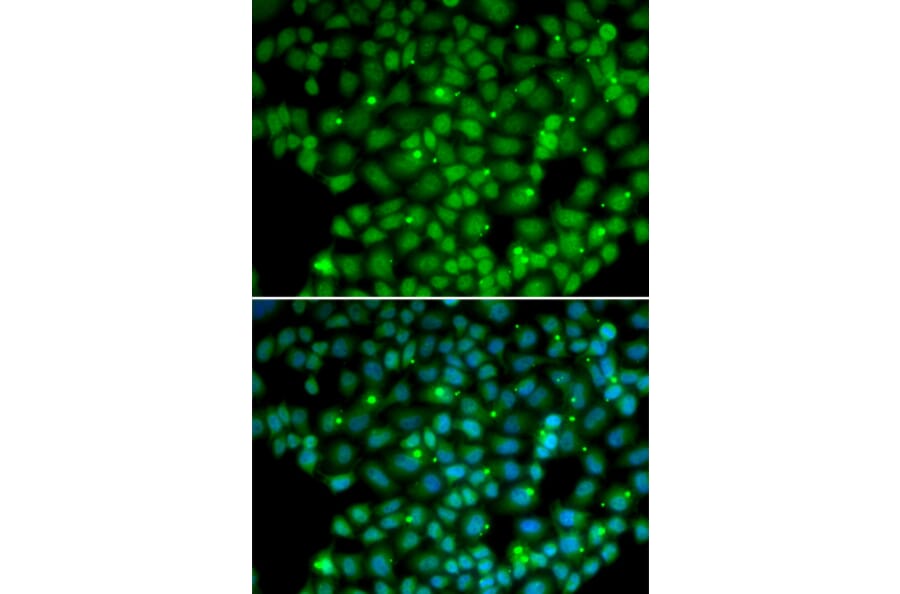 Immunofluorescence - MUTYH antibody from Signalway Antibody (38267) - Antibodies.com