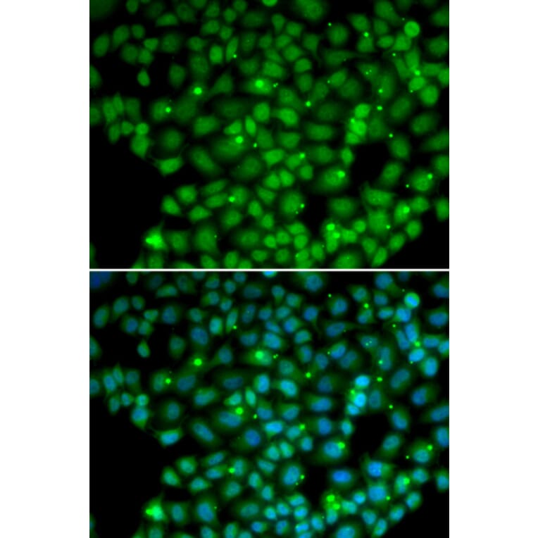 Immunofluorescence - MUTYH antibody from Signalway Antibody (38267) - Antibodies.com