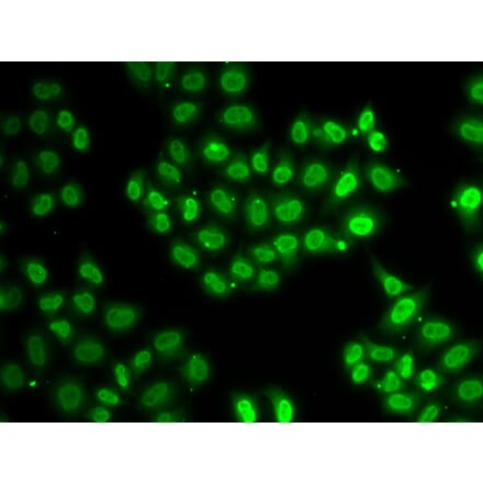 Immunofluorescence - EWSR1 antibody from Signalway Antibody (38281) - Antibodies.com