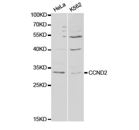 Western blot - CCND2 antibody from Signalway Antibody (38295) - Antibodies.com