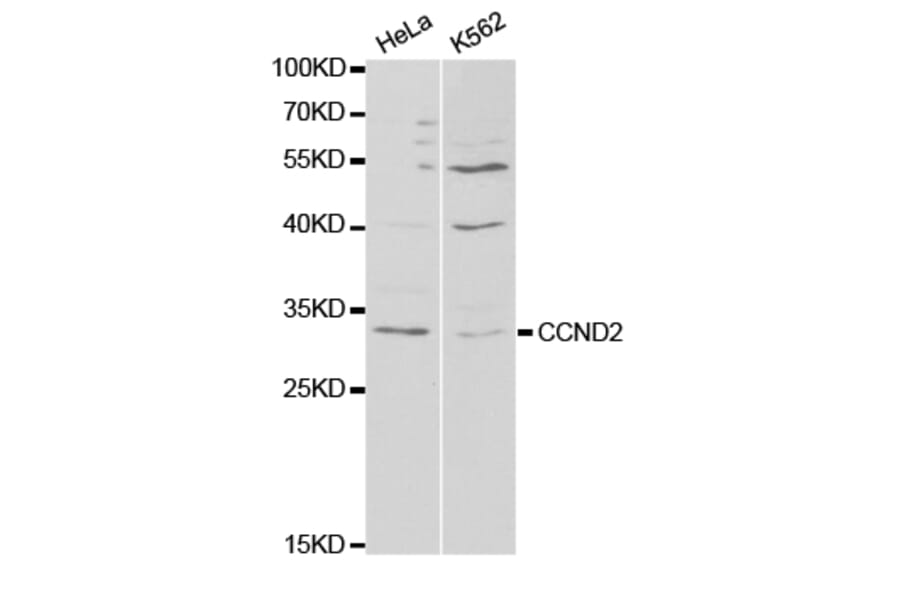Western blot - CCND2 antibody from Signalway Antibody (38295) - Antibodies.com