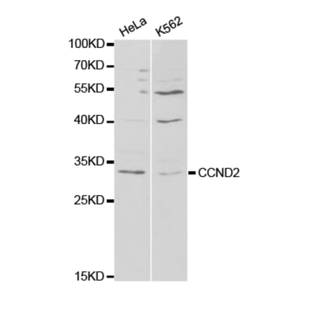 Western blot - CCND2 antibody from Signalway Antibody (38295) - Antibodies.com