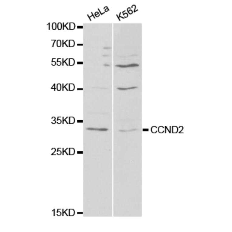 Western blot - CCND2 antibody from Signalway Antibody (38295) - Antibodies.com