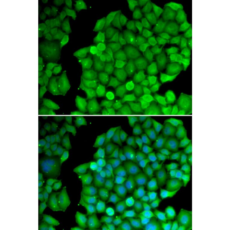 Immunofluorescence - CCND2 antibody from Signalway Antibody (38295) - Antibodies.com