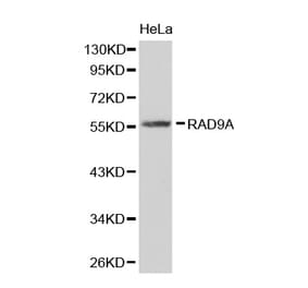 Western blot - RAD9A antibody from Signalway Antibody (38314) - Antibodies.com