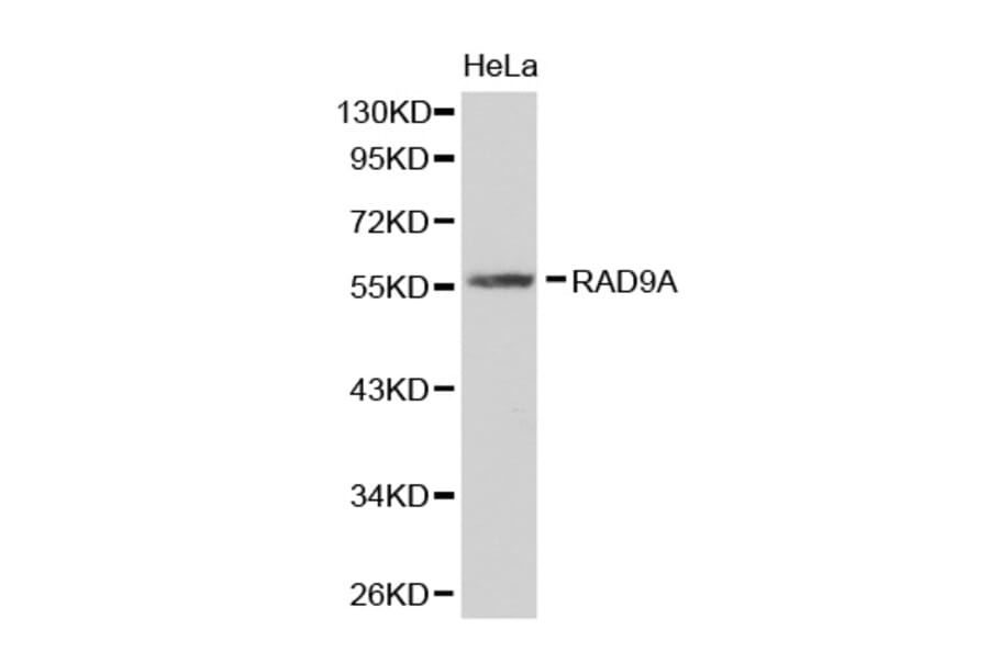 Western blot - RAD9A antibody from Signalway Antibody (38314) - Antibodies.com
