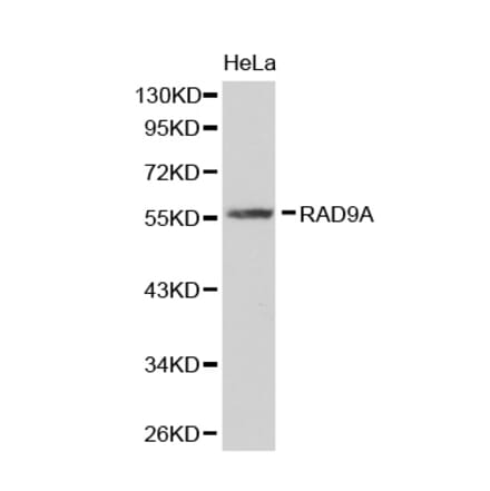 Western blot - RAD9A antibody from Signalway Antibody (38314) - Antibodies.com