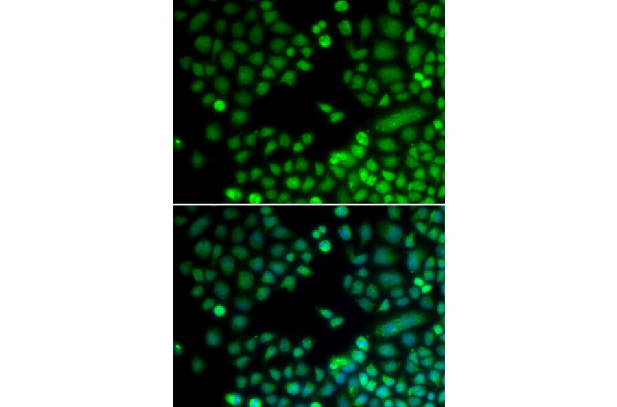 Immunofluorescence - RAD9A antibody from Signalway Antibody (38314) - Antibodies.com