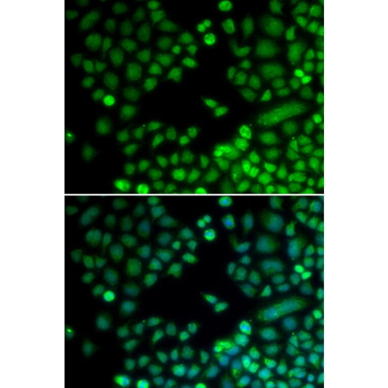Immunofluorescence - RAD9A antibody from Signalway Antibody (38314) - Antibodies.com