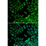 Immunofluorescence - RAD9A antibody from Signalway Antibody (38314) - Antibodies.com