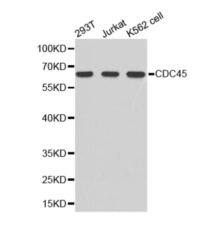 Western blot - cdc45 antibody from Signalway Antibody (38344) - Antibodies.com