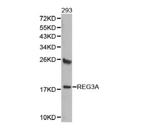 Western blot - REG3A antibody from Signalway Antibody (38363) - Antibodies.com