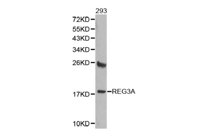 Western blot - REG3A antibody from Signalway Antibody (38363) - Antibodies.com